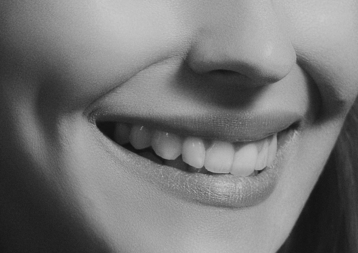 female smiling white teeth