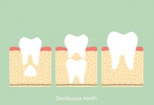 deciduous tooth exfoliation guide